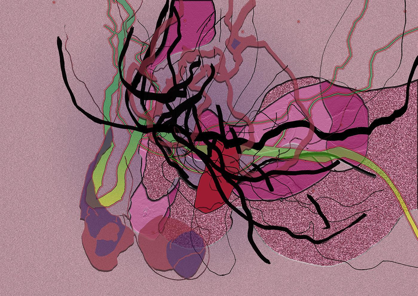 30- LI  CL - SEXE 30- LI  CL - SEXE