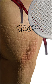 11-SIEGE.jpg