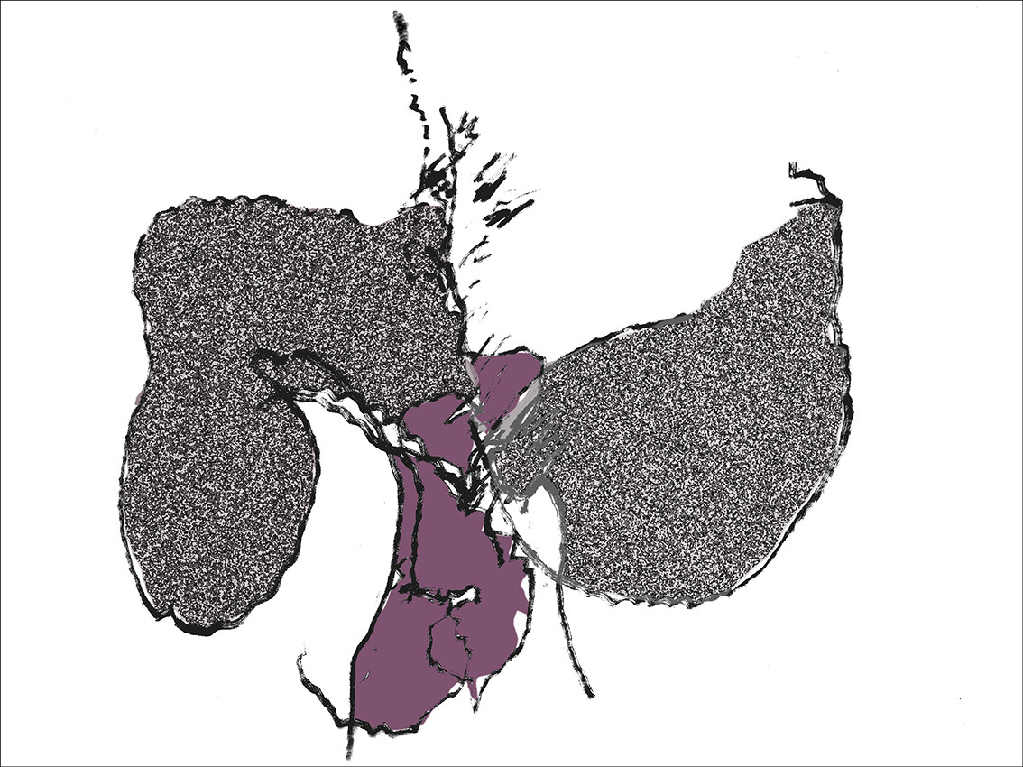 37- OD  CL - SEXE DOS 2